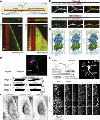 Cellular cartography: Towards an atlas of the neuronal microtubule cytoskeleton